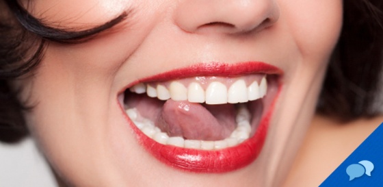 Soladey Canada Digital - Natural Teeth Whitening