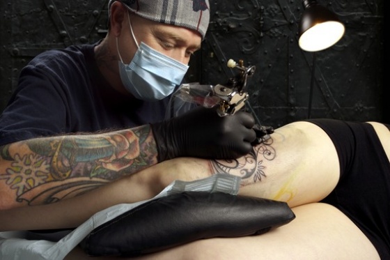 West Coast Laser Tattoo Removal - laser tattoo removal