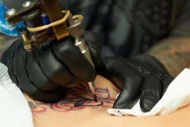 West Coast Laser Tattoo Removal, Vancouver
