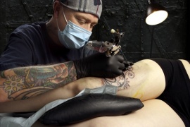 West Coast Laser Tattoo Removal, Vancouver